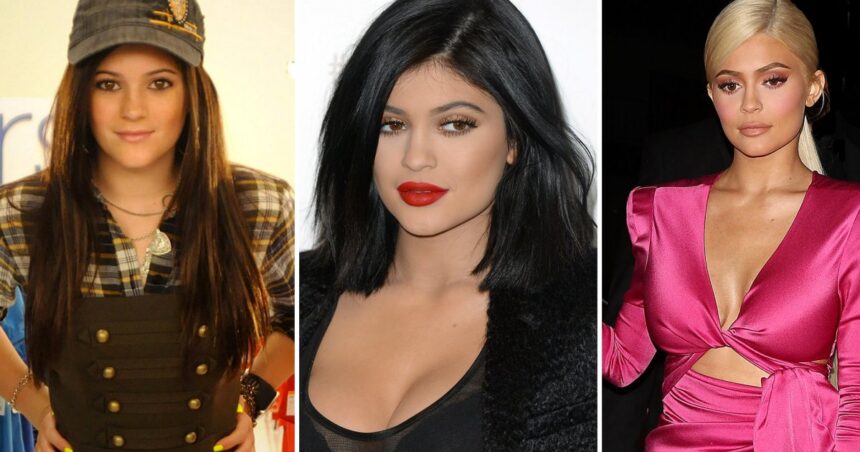 Kylie Jenner avant après
