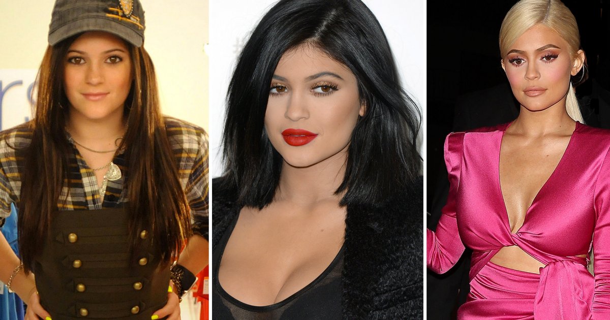 Kylie Jenner avant après